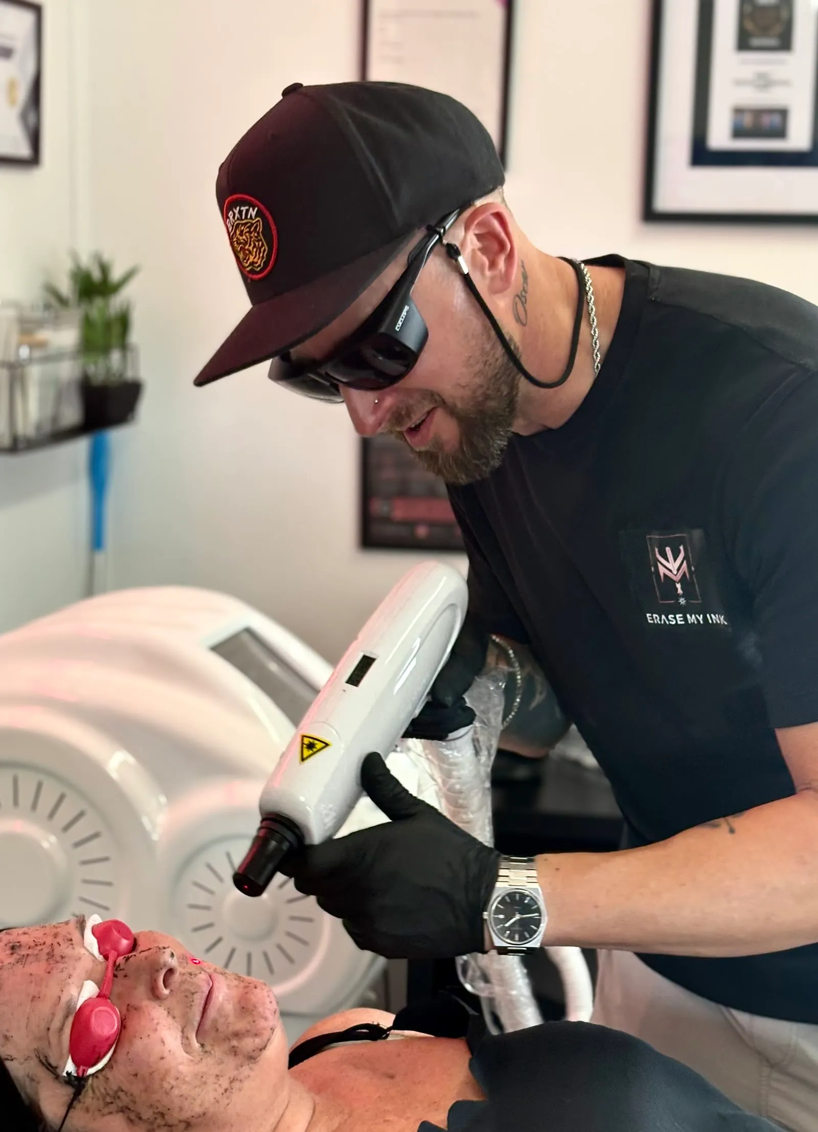Aaron carrying out a carbon laser facial at the Erase My Ink clinic in Chelmsford