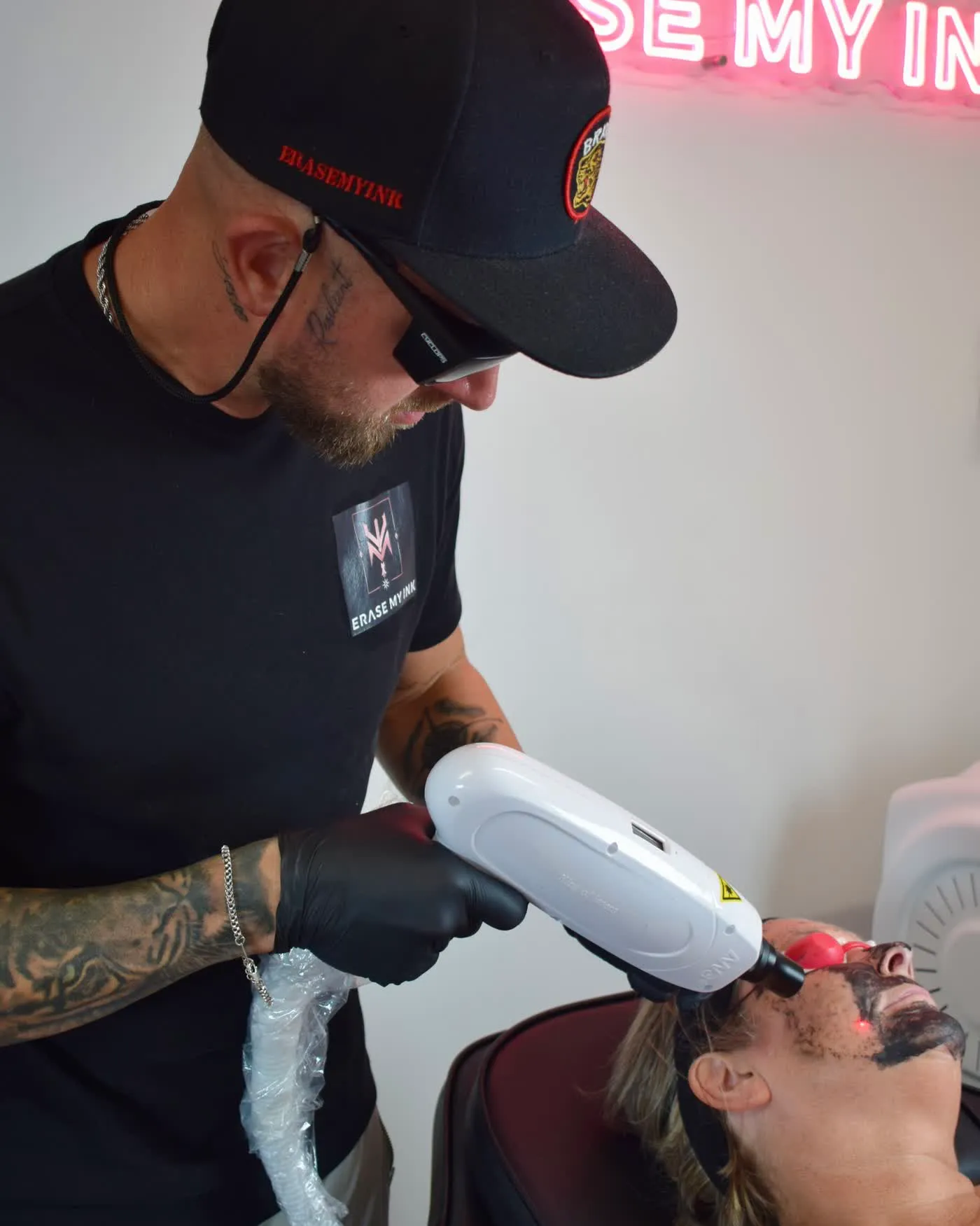Aaron carrying out a carbon laser facial in Chelmsford, the carbon paste applied to the client's skin and the laser at the point of contact
