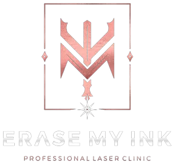 Erase My Ink, professional laser clinic