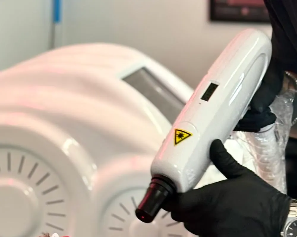 The AW3 Q-switched Nd:YAG laser in the Erase My Ink treatment room